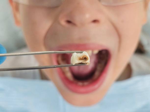 Best Emergency Broken Tooth Repair in Lykens, PA